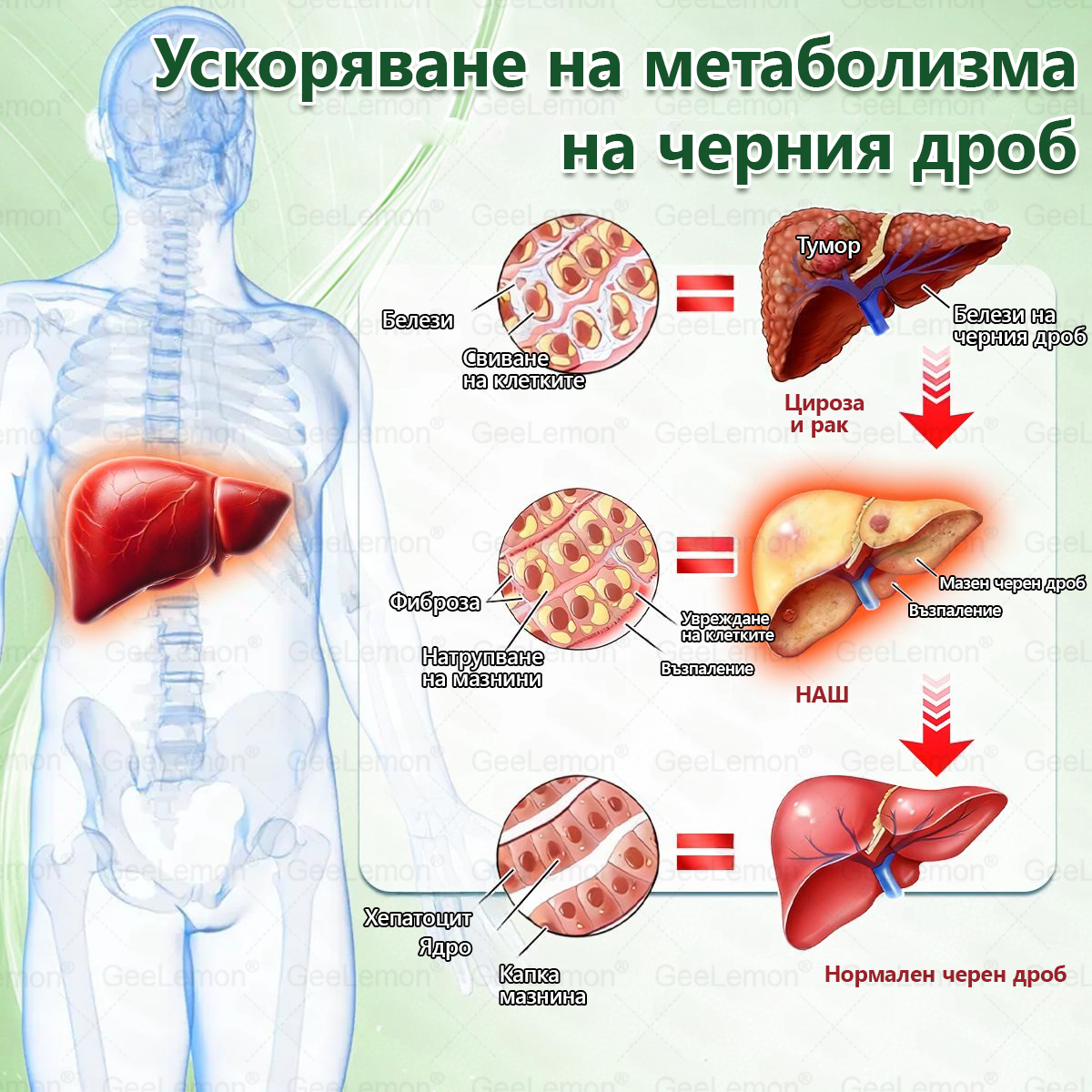 Официален магазин 👩‍⚕️ 𝐆𝐞𝐞𝐥𝐞𝐦𝐨𝐧® 𝐆𝐥𝐮𝐦𝐚𝐬𝐞𝐭𝐢𝐝𝐞 𝟖 в 𝟏 – Нано микроиглен пластир за отслабване | Само 1× дневно ✅ Видими промени за 7 дни – при затлъстяване, сърдечно-съдово здраве, диабет и ставни проблеми