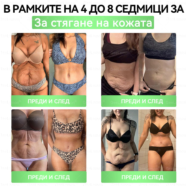Официален магазин 👩‍⚕️ 𝐆𝐞𝐞𝐥𝐞𝐦𝐨𝐧® 𝐆𝐥𝐮𝐦𝐚𝐬𝐞𝐭𝐢𝐝𝐞 𝟖 в 𝟏 – Нано микроиглен пластир за отслабване | Само 1× дневно ✅ Видими промени за 7 дни – при затлъстяване, сърдечно-съдово здраве, диабет и ставни проблеми