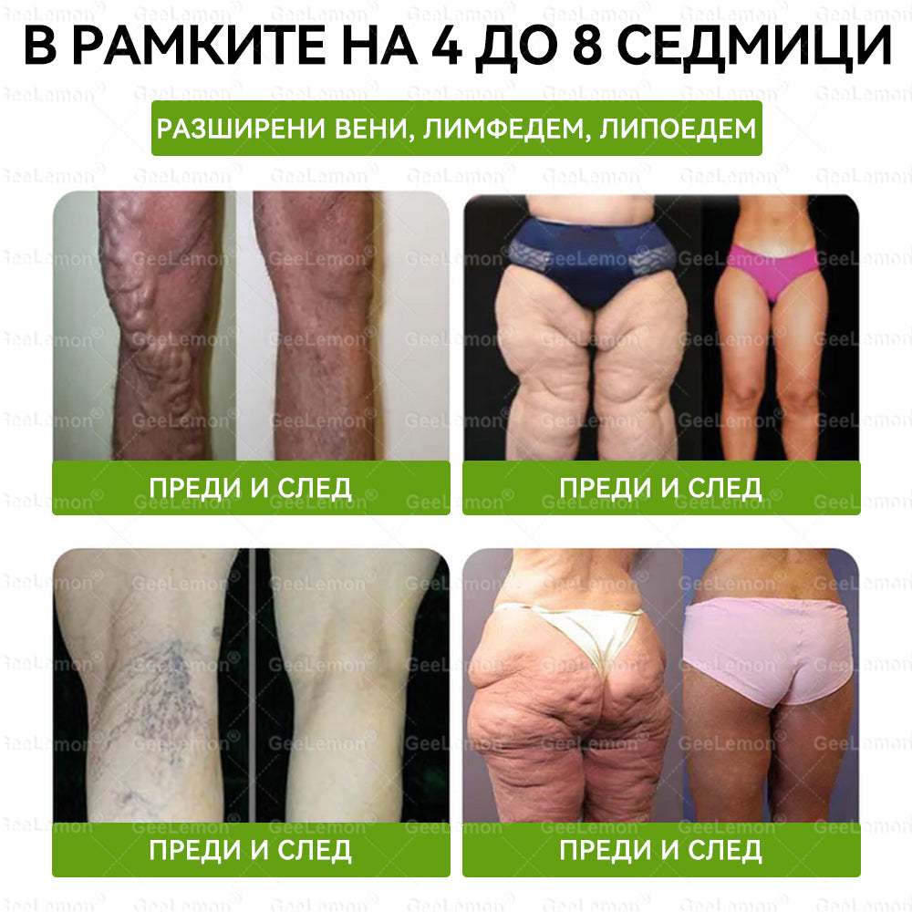 Официален магазин 👩‍⚕️ 𝐆𝐞𝐞𝐥𝐞𝐦𝐨𝐧® 𝐆𝐥𝐮𝐦𝐚𝐬𝐞𝐭𝐢𝐝𝐞 𝟖 в 𝟏 – Нано микроиглен пластир за отслабване | Само 1× дневно ✅ Видими промени за 7 дни – при затлъстяване, сърдечно-съдово здраве, диабет и ставни проблеми