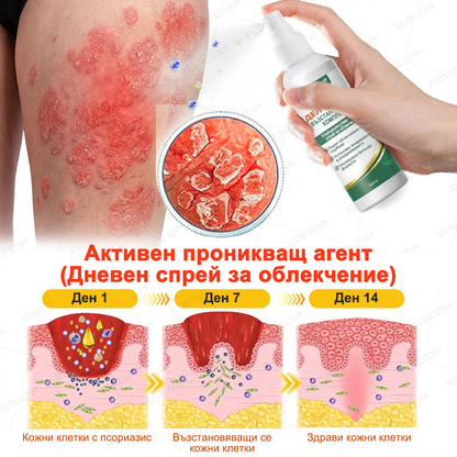 💎KUBOZN® Псориазис Дневна и Нощна Възстановяваща Система – 100% Без Стероиди Дуо за Облекчение при Плаки, Лющене и Сърбеж