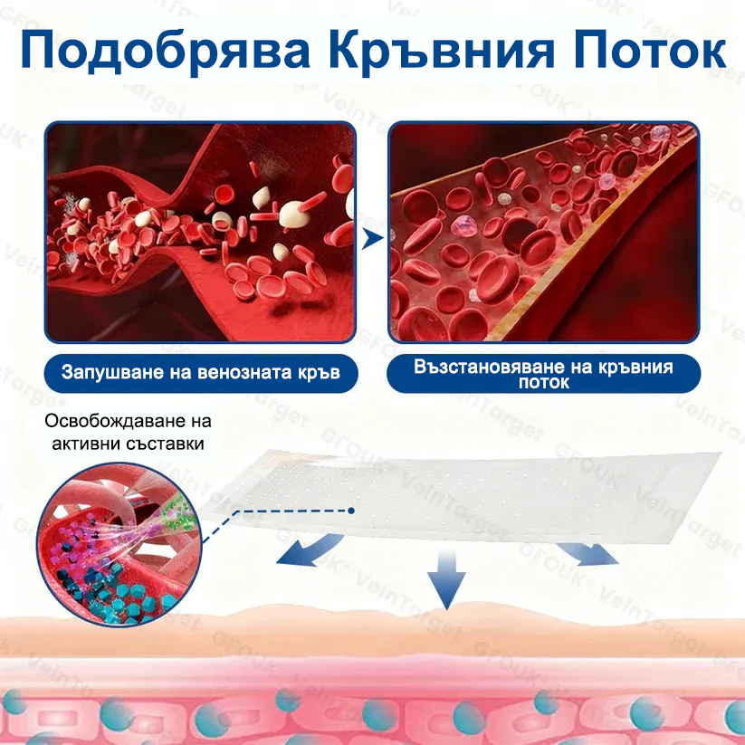🎁GFOUK® Целенасочен микроиглен пластир за вени⚡Незабавно облекчение · Дълготрайни резултати